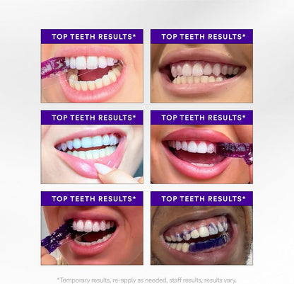 30-Minute Teeth Whitening Strips